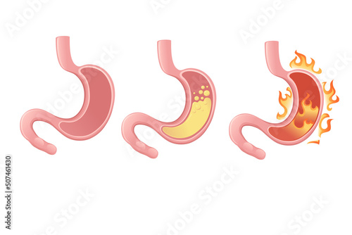 Human Stomach cartoon design human anatomy organ vector illustration on white background