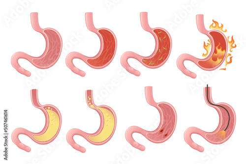 Set of Human Stomach cartoon design human anatomy organ vector illustration on white background