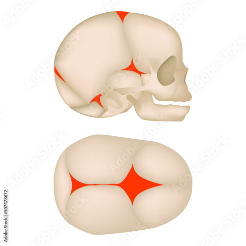The skeleton of a child with the designation of not overgrown fontanelles. Medical vector illustration