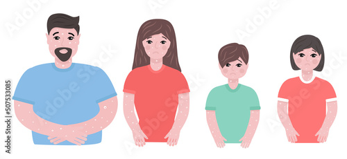 Sad people suffering from monkey pox . Symptoms of monkeypox. Ulcers on skin.