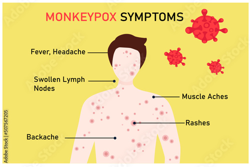 Monkeypox virus symptom concept. Patient with symptom of monkey pox virus, fever, headache, swollen lymph node, rashes and back, muscle aches  vector illustration photo