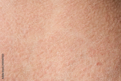 background of a pink skin texture. Healthy skin. Macro photo of skin cells.