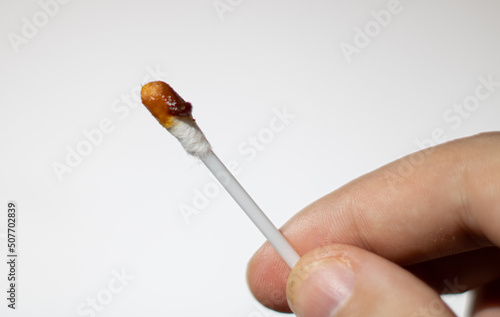 cotton bud with earwax in hand photo