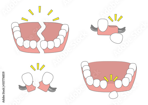 入れ歯が壊れたイメージ