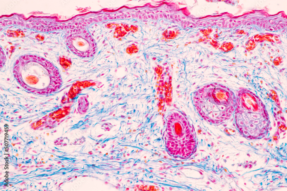 Scalp and hair follicles of human under the microscope in Lab. Scalp and hair follicles of human under the microscope in Lab.