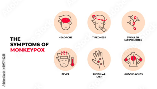 The symptoms of Monkeypox virus infographic vector.