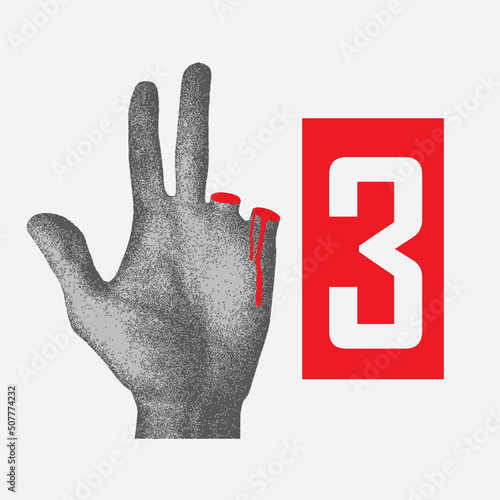 pointer number 3 from a hand with a severed finger