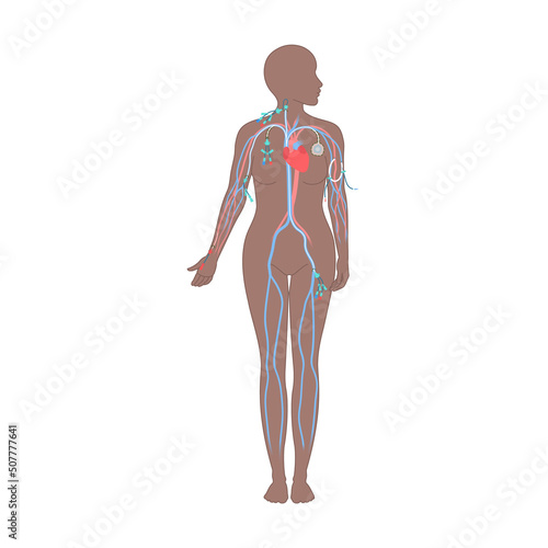 Central venous catheter placement sites shown on the female body. Types of central lines. Woman with CVC access devices. PICC, arterial line, implantable port for infusion. Medical vector illustration
