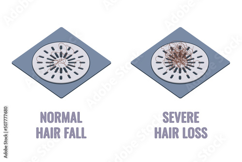 Hair clumps stuck in the shower drain grids. Normal hair fall versus severe hair loss. Alopecia symptom concept. Cartoon vector illustration