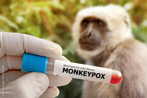 Fotografi A medical worker holds a test tube with Monkeypox virus infected blood sample in his hands,hands in gloves close-up