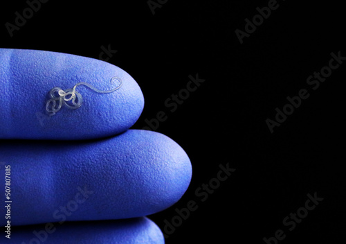 Anisakis nematode worms on the finger of a doctor's or veterinarian's glove photo