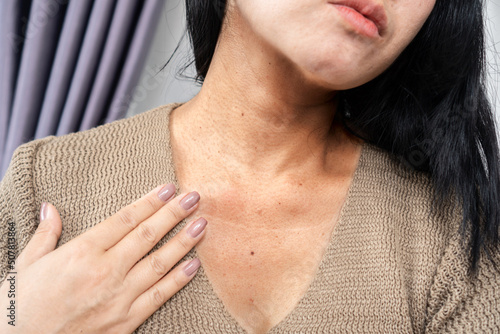 Quadro su tela closeup woman having a problem with neck wrinkles, dark skin, aging process conc