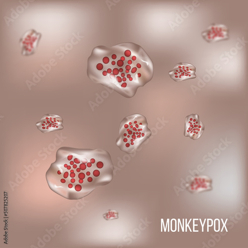 Monkeypox virus, monkeypox cells, vector