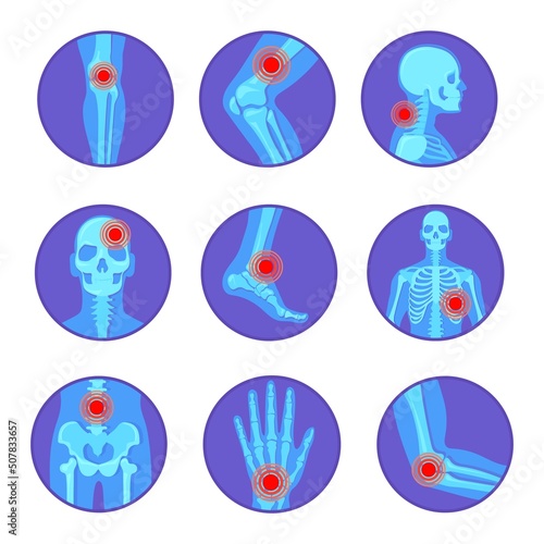 Orthopedic joint diseases. Rheumatoid pain bone knee hand elbow arthritis, rheumatology human skeleton body xray medicine surgery foot skull pelvis cartoon neat vector illustration