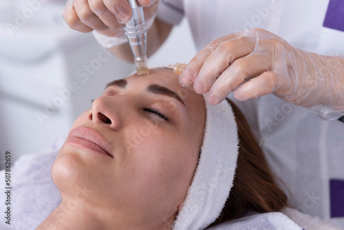 close up of Cosmetologist,beautician applying facial dermapen treatment on face of young woman customer in beauty salon.Cosmetology and professional skin care, face rejuvenation. photo
