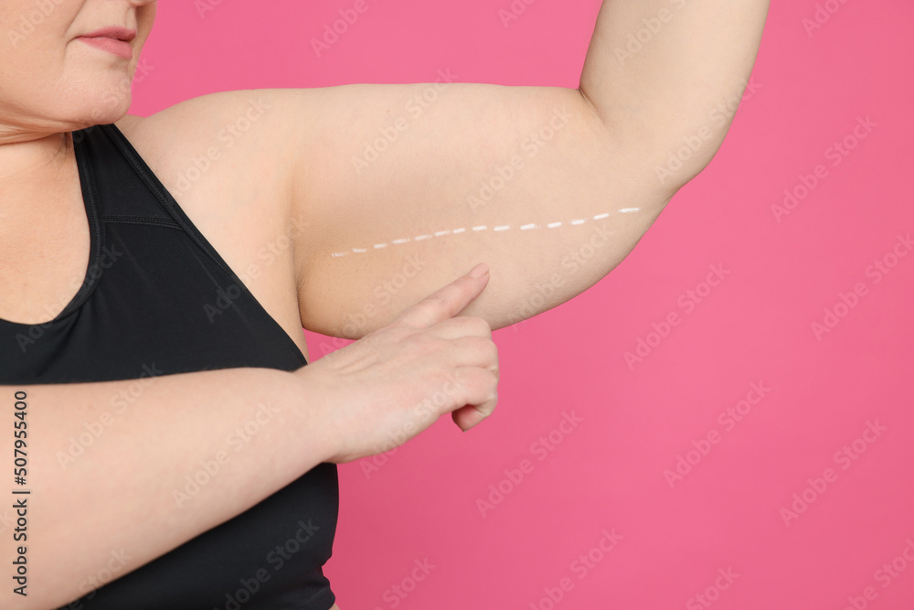 Obese woman with flabby arm on pink background, closeup. Weight loss surgery