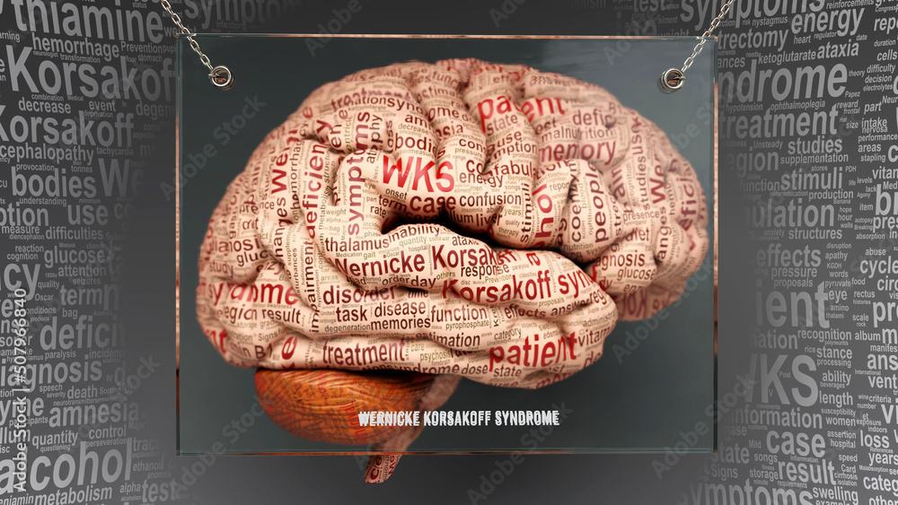 Was Ist Das Korsakow Syndrom Wernicke korsakoff syndrome in human brain - dozens of terms describing