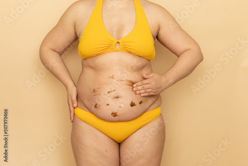 Fat woman in yellow swimsuit apply brown body cream on thick sagging stomach, beige background. Slimming, fighting overweight, obesity and cellulite. Plus size people and body positive concept.