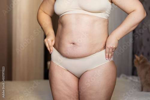 Cropped image overweight fat woman stomach with obesity, excess fat in shape underwear. Arms pulling, hiding big excessive belly with navel. Stomach flabs with friable skin, visceral fat. Close up photo