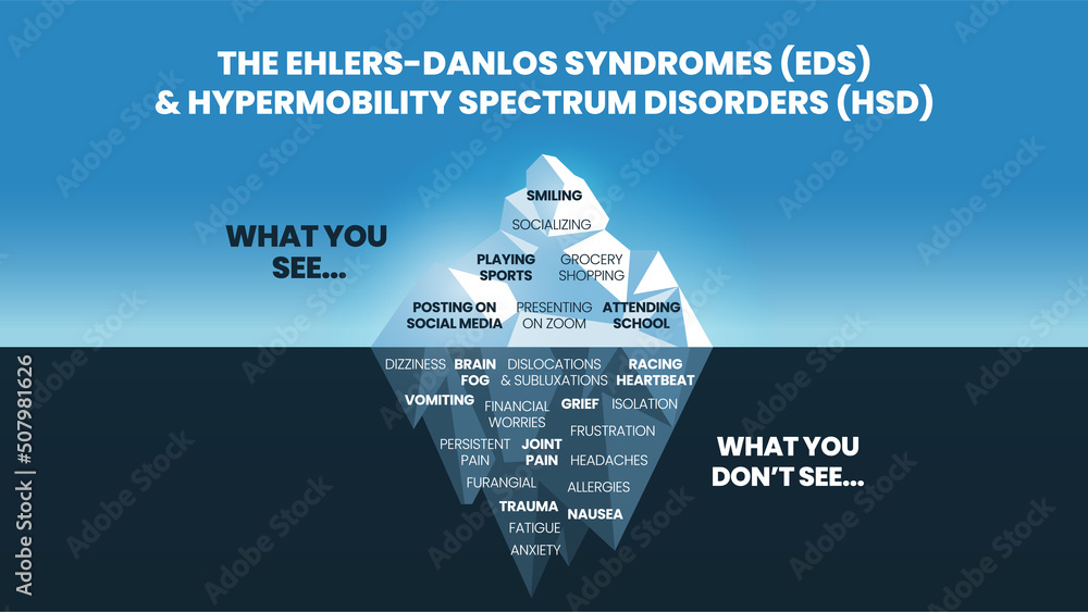 The iceberg model of EhlersDanlos Syndromes (EDS) and Hypermobility