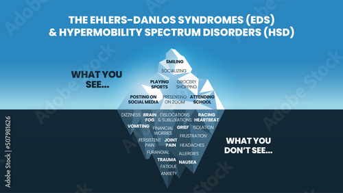 The iceberg model of Ehlers-Danlos Syndromes (EDS) and Hypermobility spectrum disorder (HDS) concept has the surface symptom can see happy and normal behavior for phycological analysis and diagnostic  photo