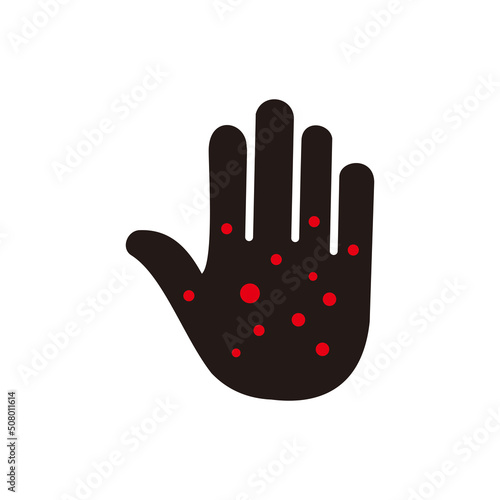 Hand rash icon. Damaged skin icon. eczema hand asking vector illustration symbol