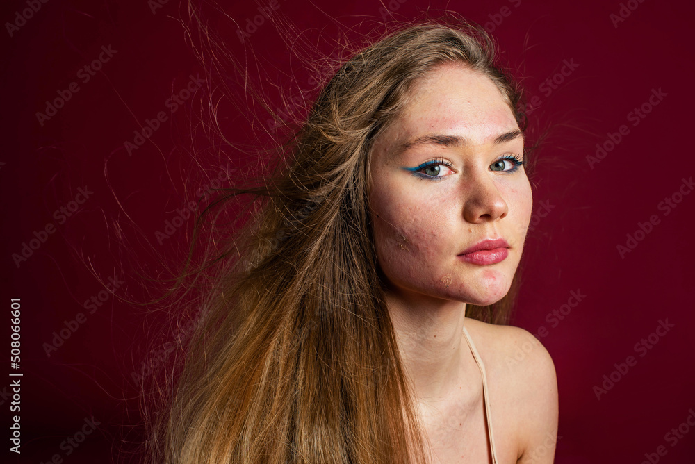 Naklejka premium Beautiful model girl woman with allergy on her face. Red background. woman having problems of acne inflammation (Papule and Pustule) on her face. Conceptual of problems on woman skin. Body positive.