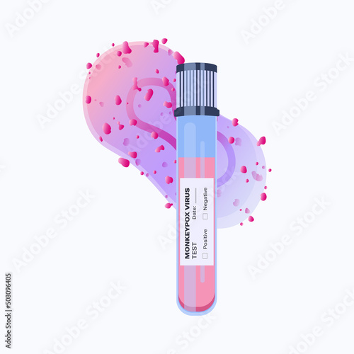 Monkeypox virus (MPXV) vector illustration Blood sample tube for Monkeypox virus test. Monkeypox virus zoonotic viral disease 