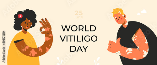 World vitiligo day. 25 june. Skin disorder. African woman and caucasian man gesturing ok and fine. Loss of melanin. Diversity, body positive, self acceptance concept. 