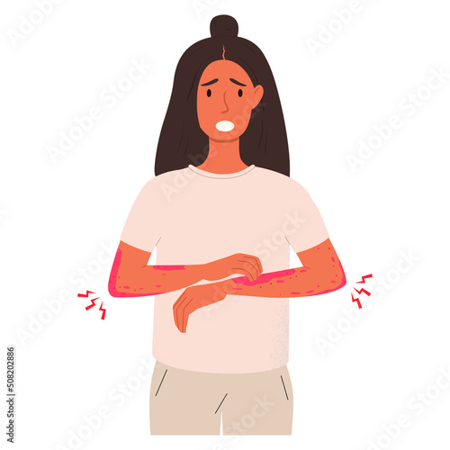 Flat vector illustration of an unhappy suffering woman scratching the skin on her hand. photo