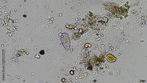 testate amoebae in a compost sample and soil sample, under the microscope, soil life and soil biology. photo