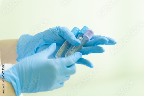 the nurse holds empty test tubes in two hands, prepares to take blood from the patient, the test tubes lie in the left hand at an angle