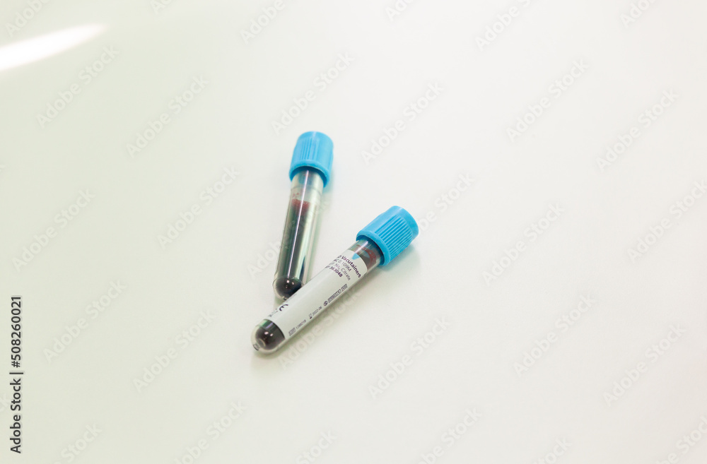 two test tubes with the patient's blood are lying on a clean white sterile table, tests, monkey pox