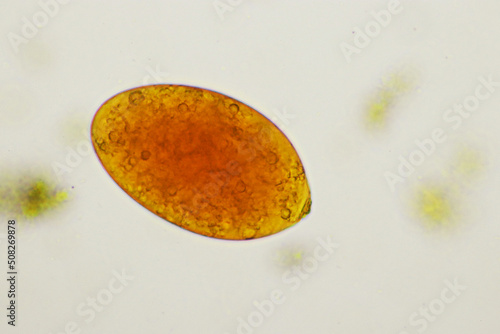 Egg of intestinal fluke in human stool, analyze by microscope, original magnification 400x photo