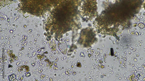 testate amoebae and Fungal and fungi hyphae under the microscope in the soil and compost, in a soil biology and microorganism test in Australia. photo