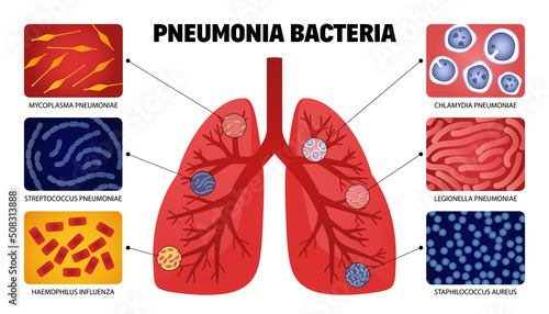 Pneumonia Bacteria Lungs Collection