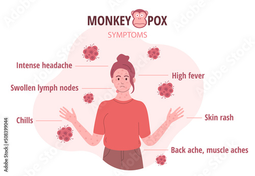 Monkey pox outbreak. Infographics of virus symptoms in humans. Vector illustration for informing people about an infectious disease
