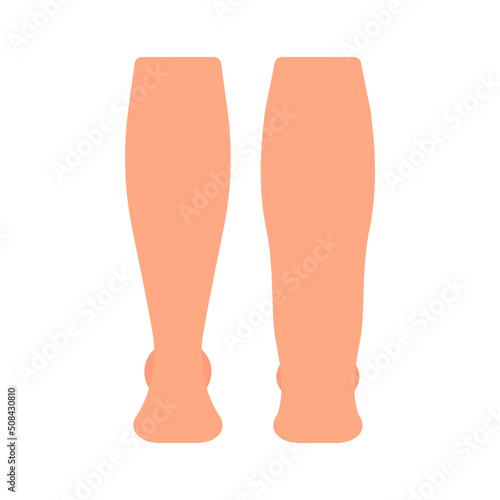 Lymphedema leg, health and disease feet, lymphoedema and lymphatic edema. Lymphatic system dysfunction. Elephantiasis, legs swelling disease. Vector illustration