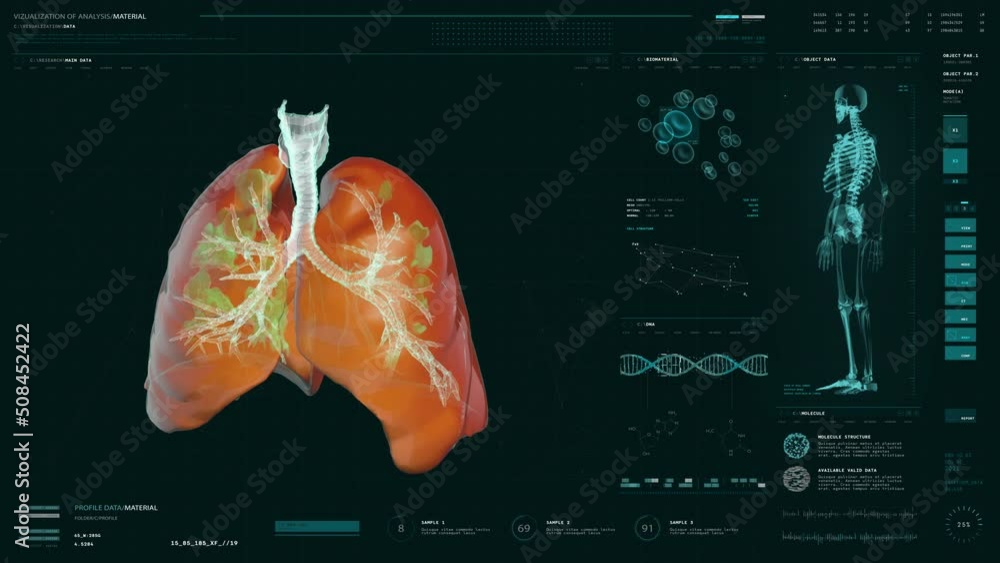 Human Patient Respiratory System Examination Via X-ray Screening Device ...