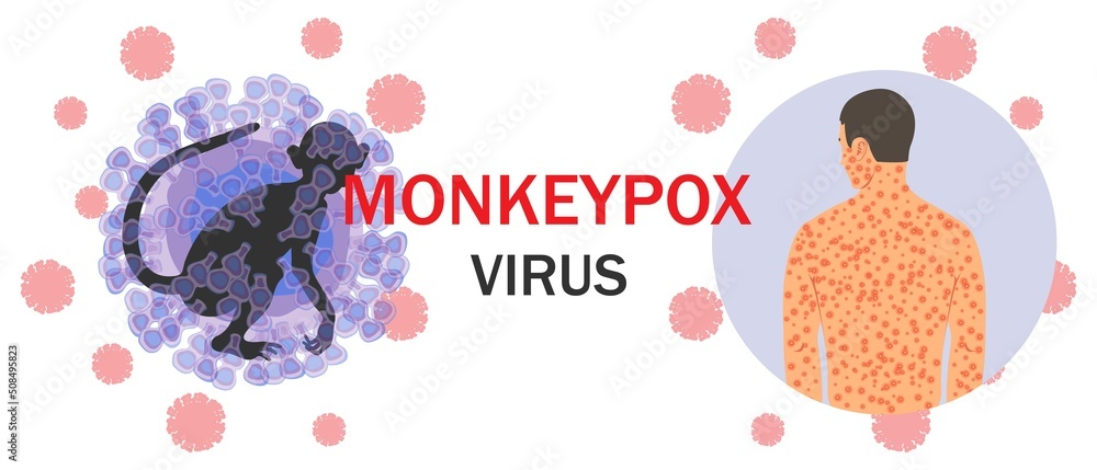 Banner with monkeypox virus cells, monkey silhouette, text and human ...