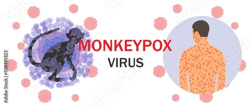 Banner with monkeypox virus cells, monkey silhouette, text and human body with rash on microbiology background. The concept of a viral disease and its symptoms. Vector illustration. photo