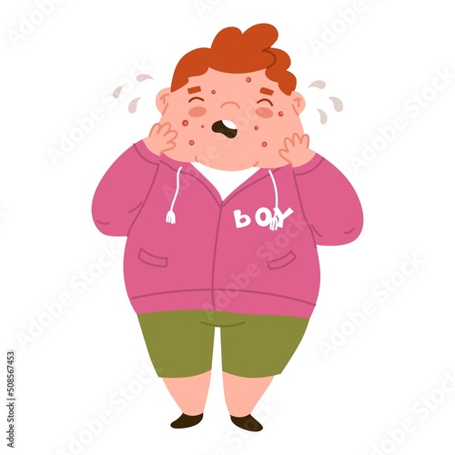Fat boy is crying because of pimples on her face. Junk food, malnutrition. Diseases of the gastrointestinal tract. Acne, skin problems, puberty. Flat style in vector illustration