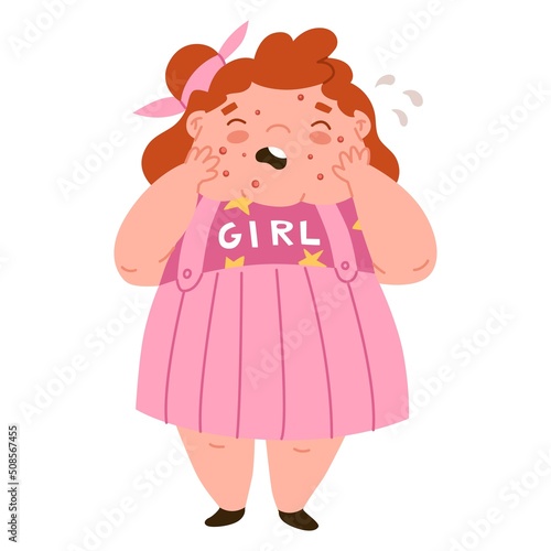 Fat girl is crying because of pimples on her face. Junk food, malnutrition. Diseases of the gastrointestinal tract. Acne, skin problems, puberty. Flat style in vector illustration