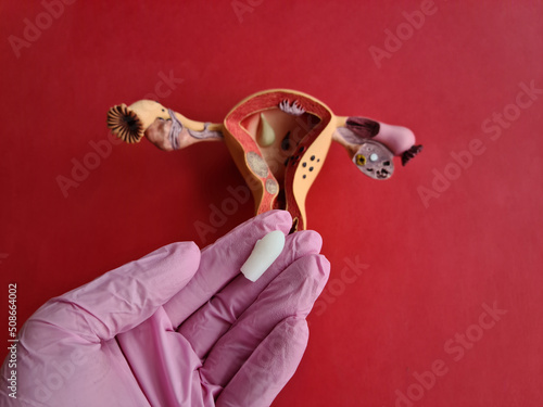 Contraceptive suppositories and anatomy of uterus closeup