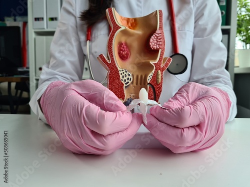 Фотография Soft suppository with laxative medicine or for treatment of proctological diseas