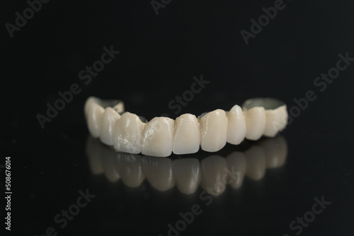 Dental ceramic bridge on isolated wite background. Metal free ceramic dental crowns. Closeup ceramic to dental implants in laboratory.