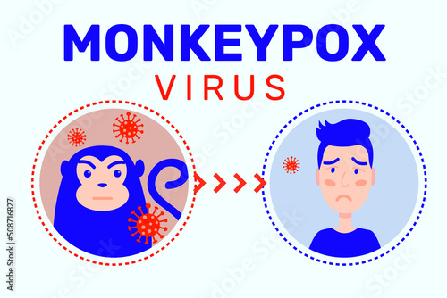 Infographic of showing monkey pox outbreak, man showing pain from blisters on skin caused by ingestion of monkeypox virus, flat design.