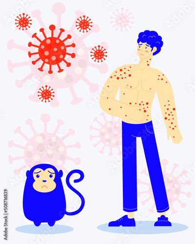 Vector illustration of showing monkey pox outbreak, man showing pain from blisters on skin caused by ingestion of monkeypox virus , flat design.