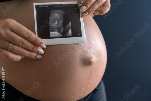 A woman in the third trimester of pregnancy with a visible, large, tense belly, holding an ultrasound photo of her unborn child in her hands. Waiting for labor. Soft focus.