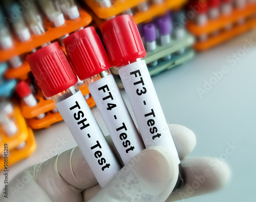 Blood samples for hormonal examination of thyroid gland in laboratory. FT3, FT4, TSH. Diagnosis of hyperthyroidism or hypothyroidism of a patient. Lab background. photo